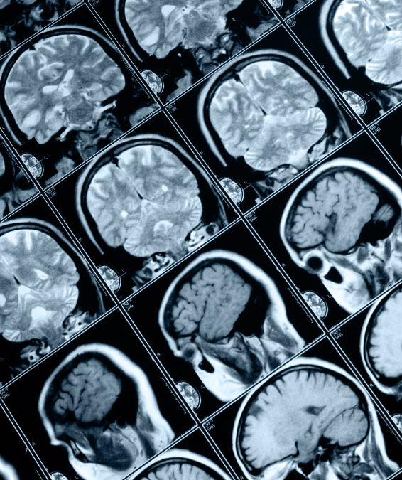 Will the 21st century focus on the brain?