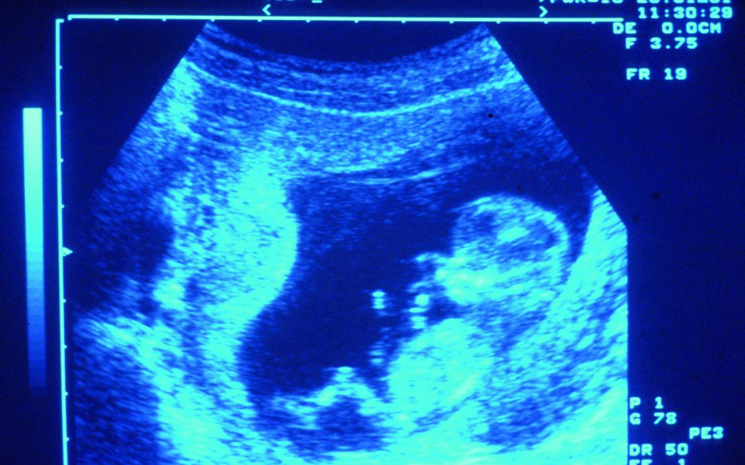 Un intervention chirurgicale in utero sauve deux foetus
