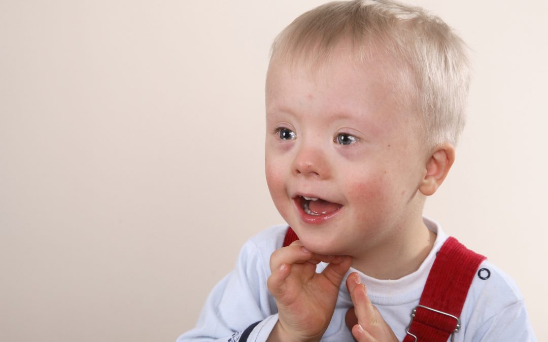 “No-one should be afraid of having a child with Down syndrome”