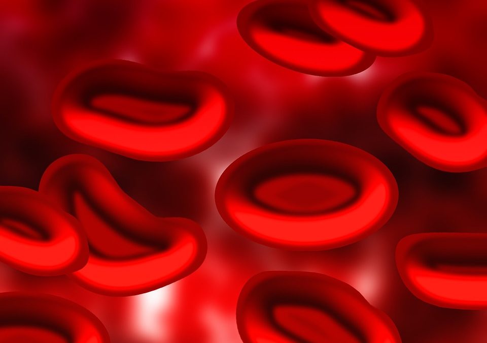 Sickle cell anaemia: initial success for gene therapy