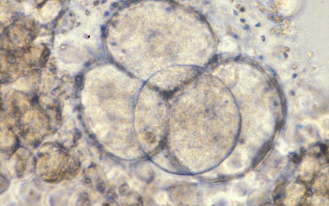 Les cellules souches embryonnaires pour traiter la sclérose en plaques plus efficace que les cellules souches adultes?
