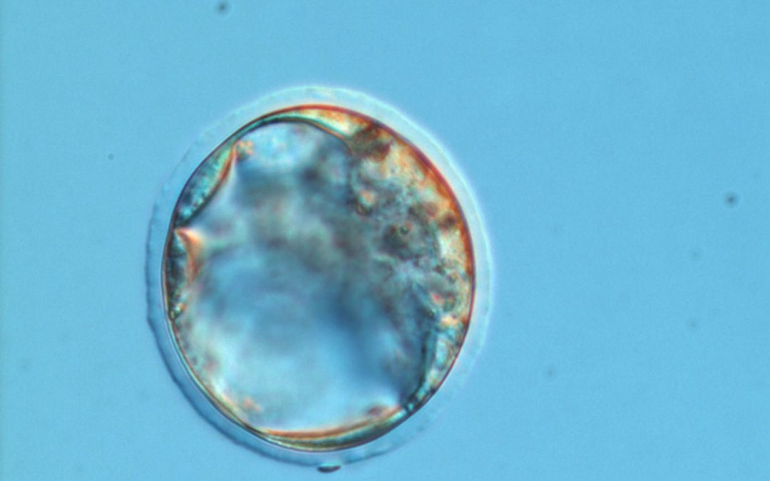 R. Frydman : ne pas définir l’embryon