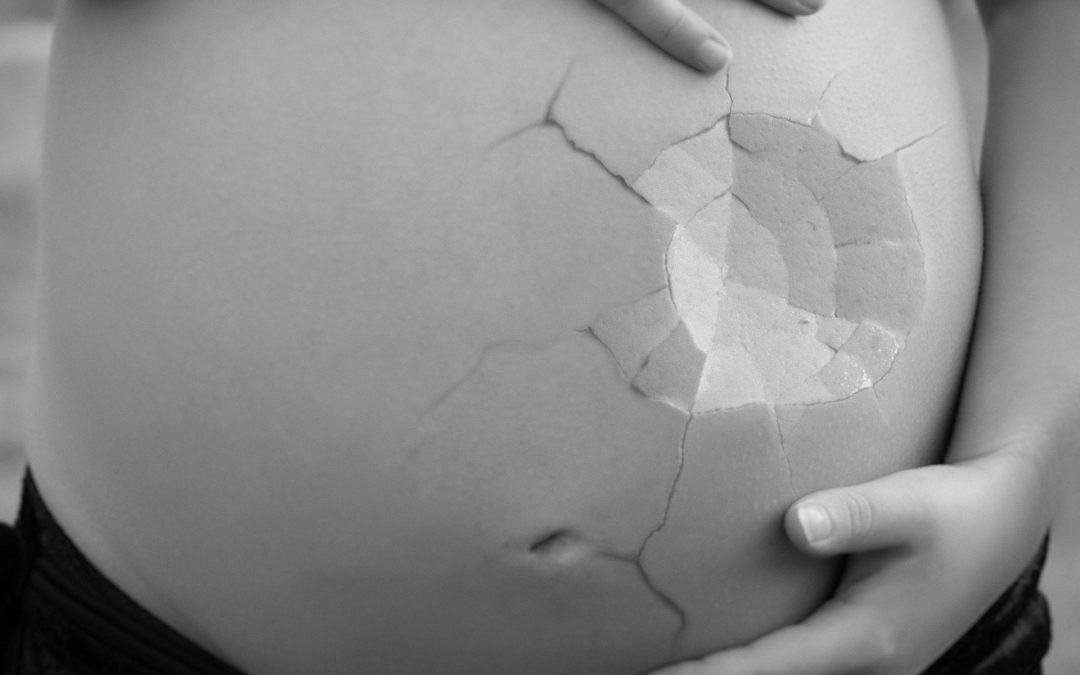 Late miscarriage: heading towards the registration of babies in the United Kingdom?