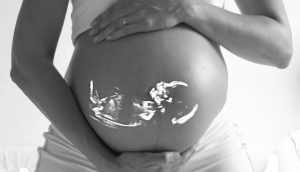 Affaire Palmade : le procureur ne retient pas l’« homicide involontaire » du fœtus