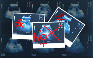 Détermination anténatale du sexe : un médecin condamné à 2 ans de prison en Inde