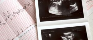 Au Brésil, avorter durant le premier trimestre de grossesse "n'est pas un crime"