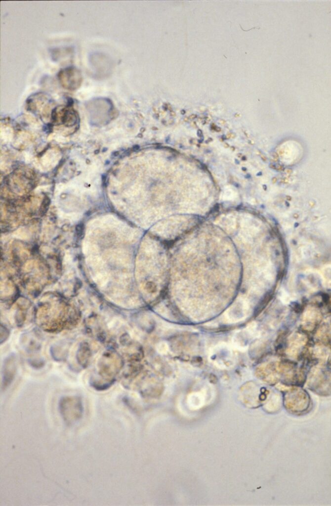 Sénat : autoriser la recherche sur l’embryon ?