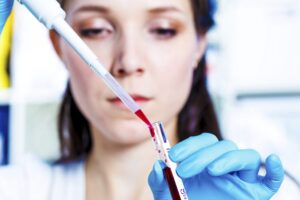 Recherche d’un médicament contre la schizophrénie en bonne voie