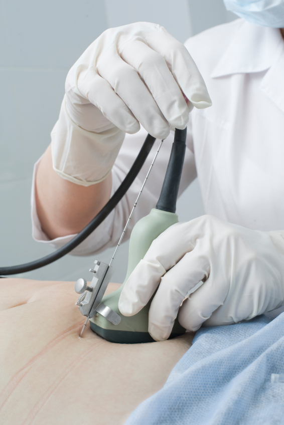 Mort d'une femme à la suite d'une amniocentèse