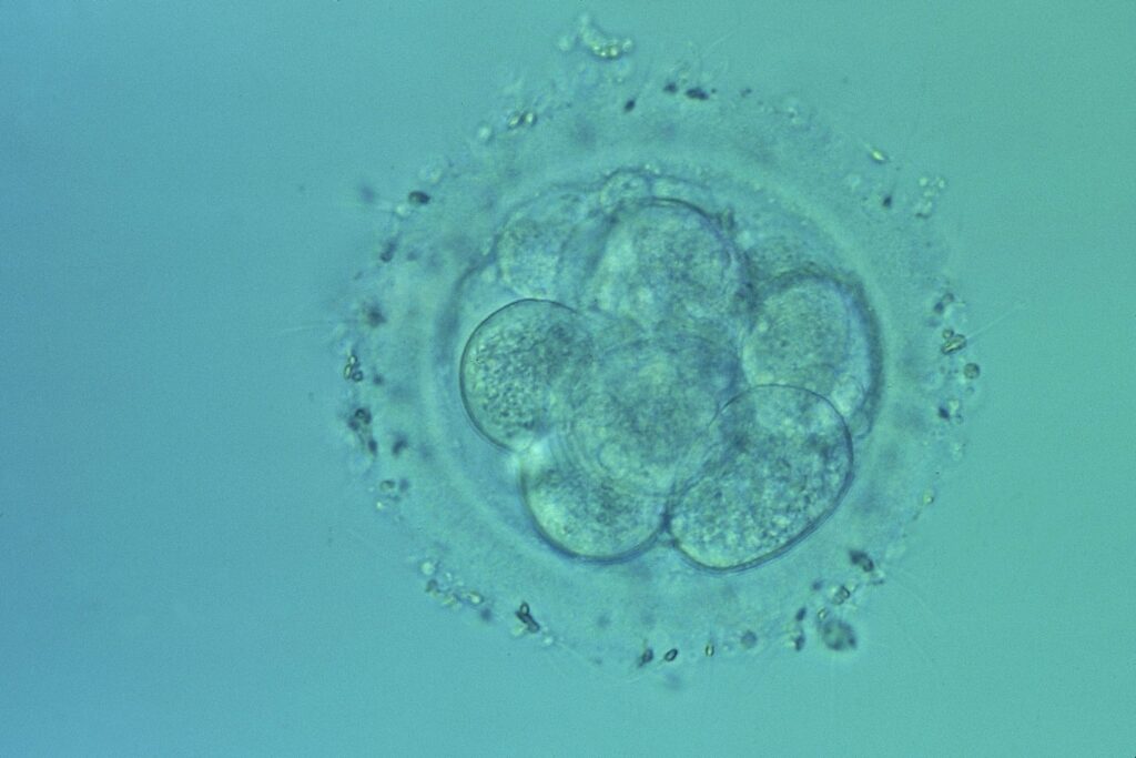 La manipulation de l'ADN, une nouvelle piste pour éviter la "FIV à 3 parents"