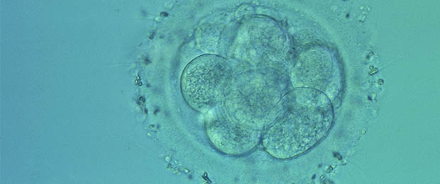 Cellules souches : des scientifiques annoncent une découverte majeure