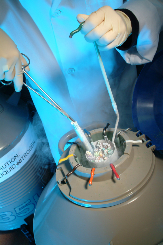 Suisse : ''absence de transparence'' sur les chiffres de la PMA