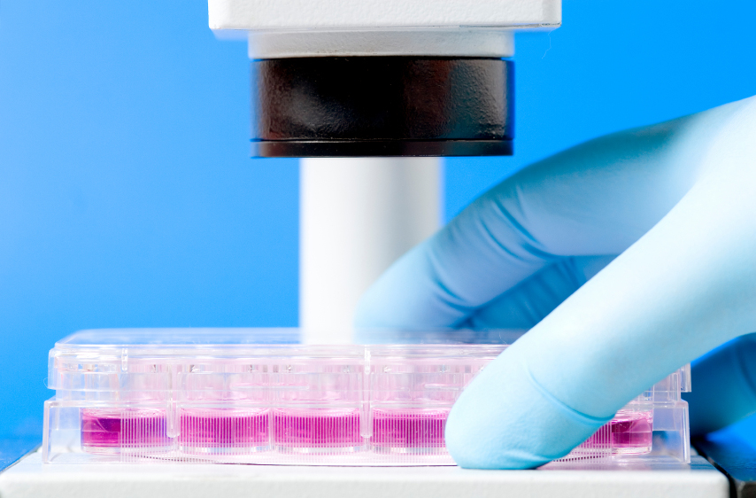 Vers la création de reins de laboratoires ?