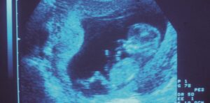 La « perte de grossesse » : une atteinte à l’intégrité des personnes selon le Code pénal belge