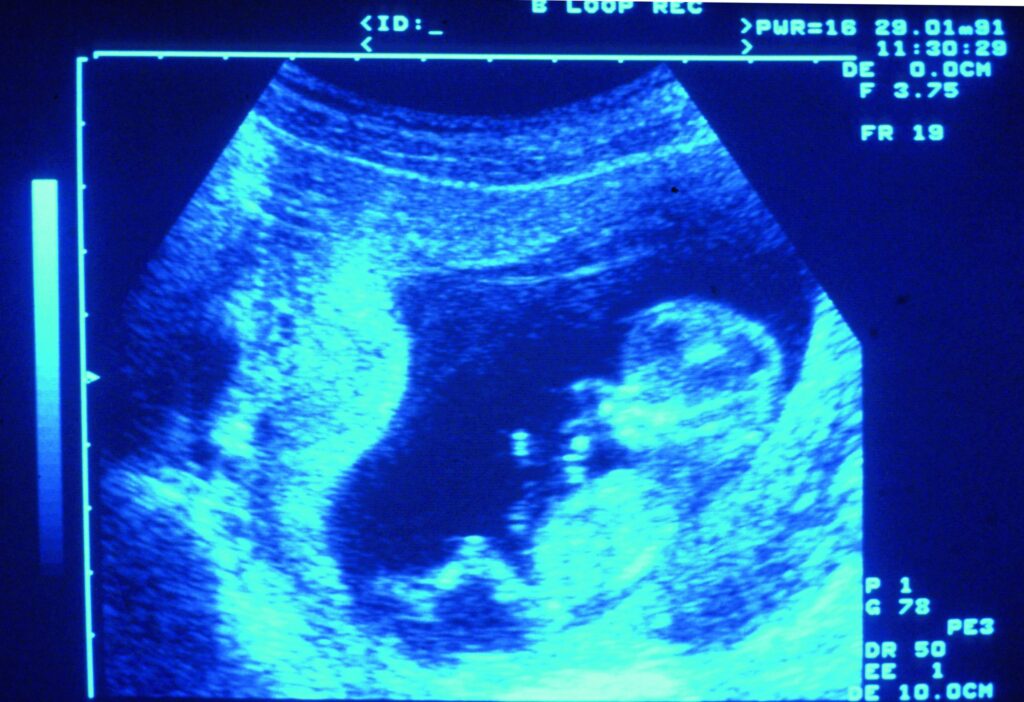 Référendum en Irlande : le gouvernement propose 21 clauses pour réguler l'avortement