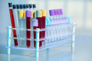 Cancer de l’œil : un test de dépistage prénatal déployé au Royaume-Uni