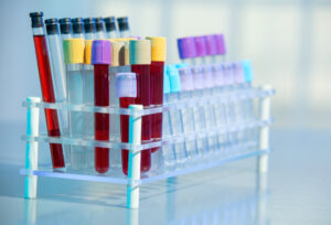 Le DPNI devient gratuit aux Pays-Bas