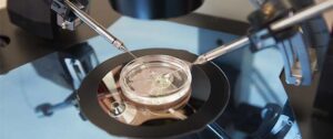 Fécondation in vitro ... 20 ans après