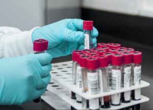 CRISPR : vers des globules rouges « sur mesure » ?