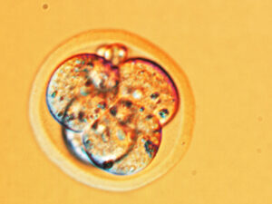 PMA : l’Espagne envoie des embryons par la poste