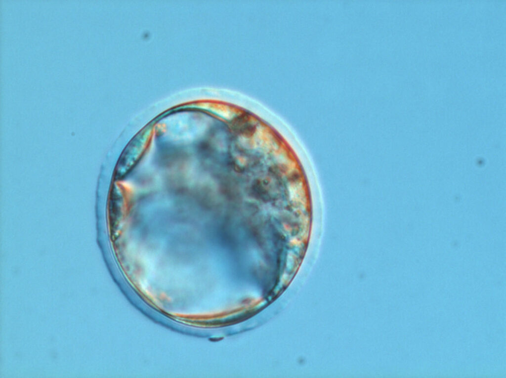 R. Frydman : ne pas définir l'embryon