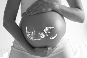 Amyotrophie spinale : un bébé traité par thérapie génique in utero