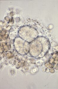 La nature de l'embryon humain au défi des lois